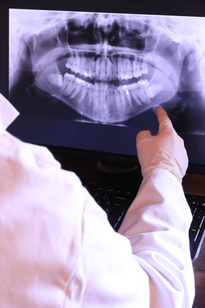 Best Emergency Root Canal Treatment in Atasdero, CA